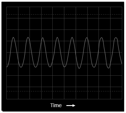 Oscilloscope display: voltage vs time
